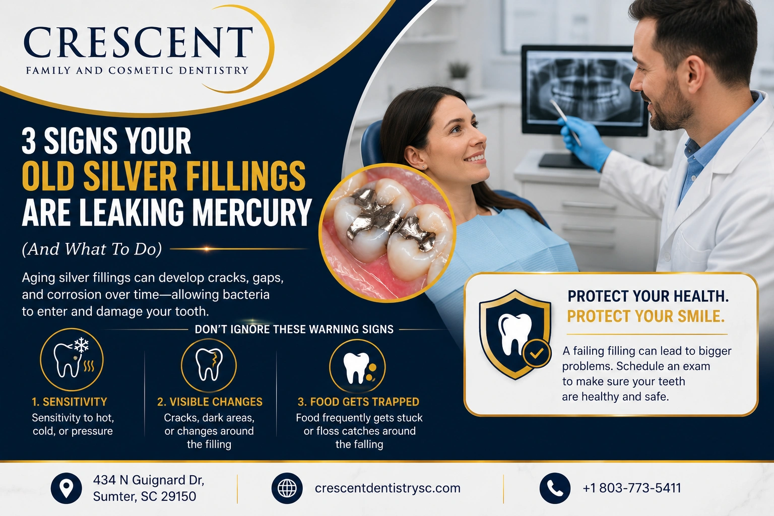 3 signs your old silver fillings are leaking mercury