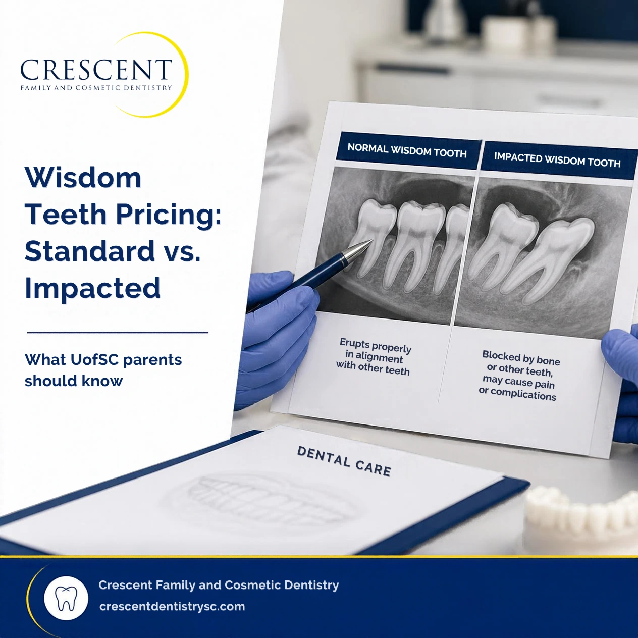 Wisdom Teeth Pricing: Standard vs. Impacted (A Guide for UofSC Parents)
