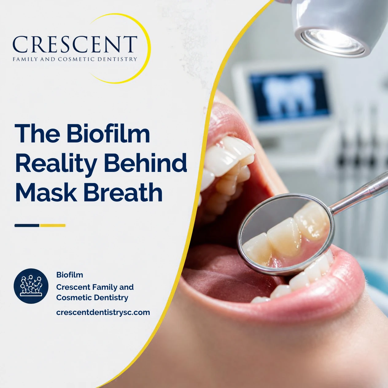 Why Your Breath Still Smells Under Your Mask: The “Biofilm” Reality