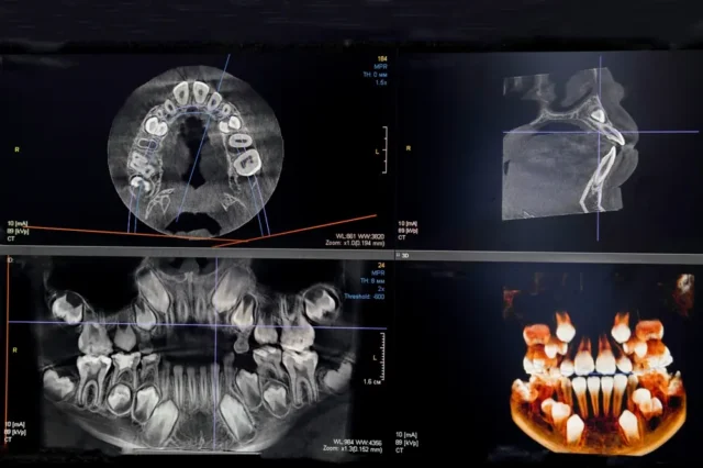 Dental Xray Sumter, SC